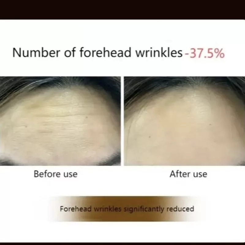 ماساژور برقی مدل BG666