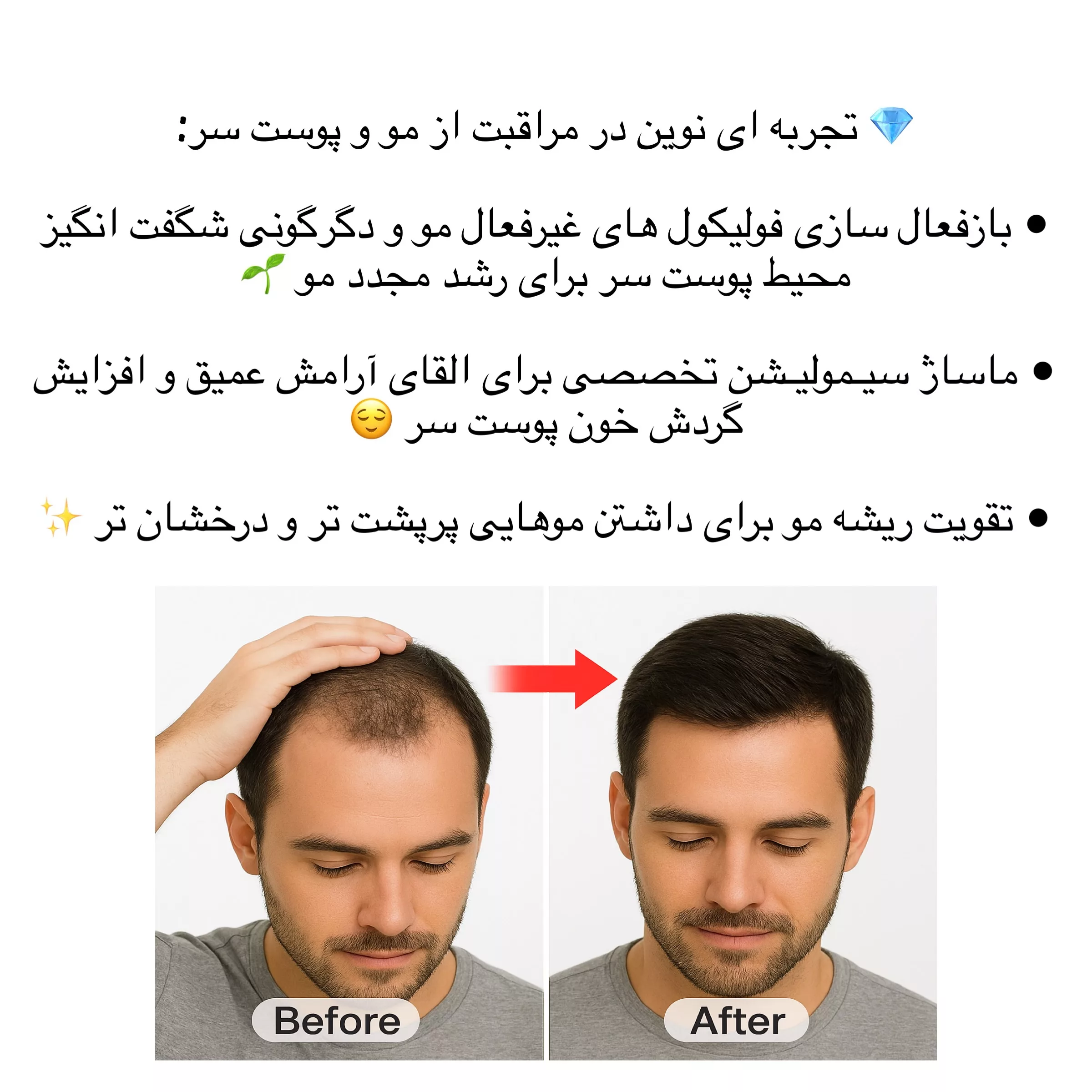 ماساژور برقی سر ریومی مدل EMS007