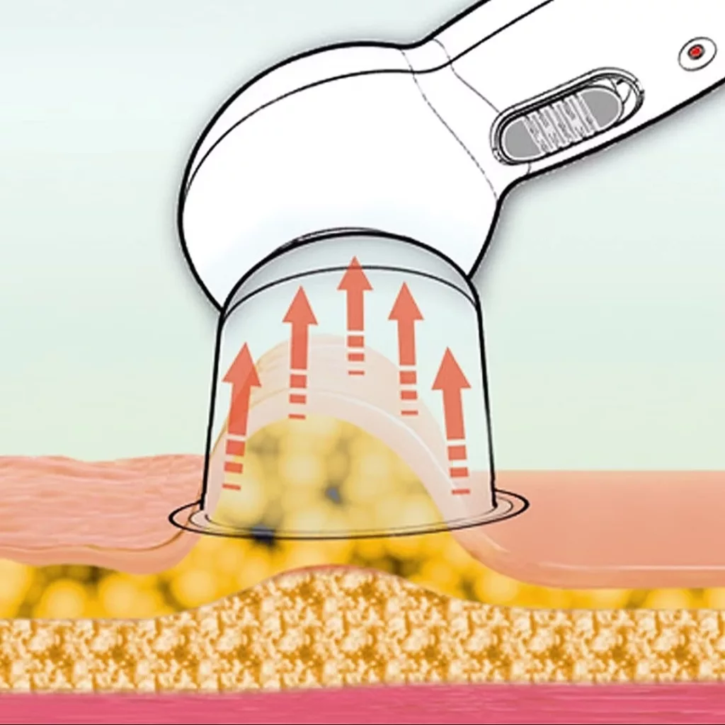 ماساژور برقی ام کیو پرفکت مدل بادکش کد AA