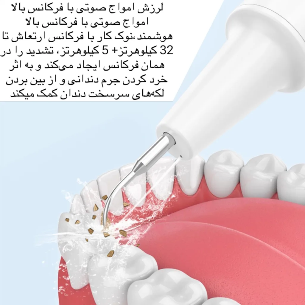 جرم گیر خانگی مدل INTELLIGENT